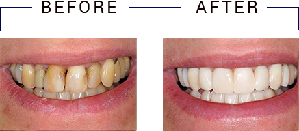 Eric C. Green, DDS | Dentures, Veneers and Extractions
