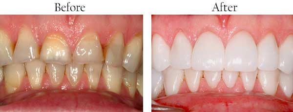 dental images 79201
